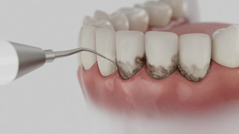 Reliable Dental Implants contractor in Obetz, OH by Smile Center Dentistry